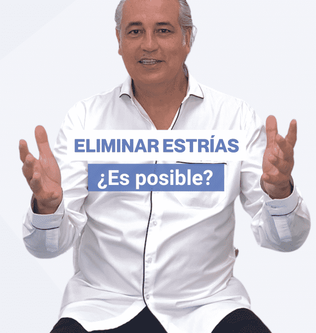 Eliminar las estrías. ¿Es posible?