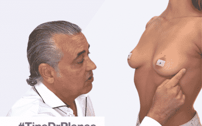 Tama&ntilde;o de las mamas