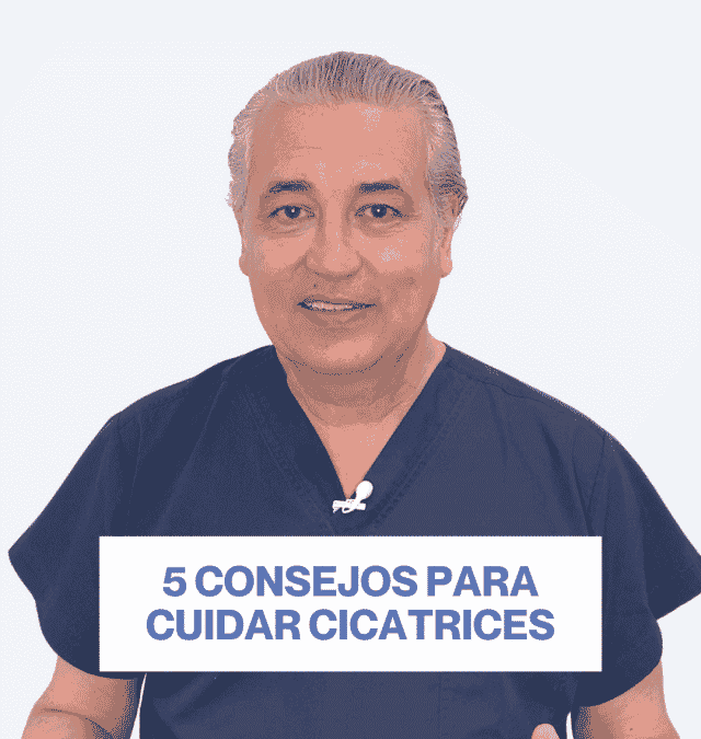 5 consejos cicatrices