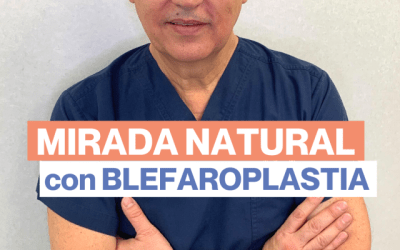 2 precauciones para dejar una mirada natural en una BLEFAROPLASTIA