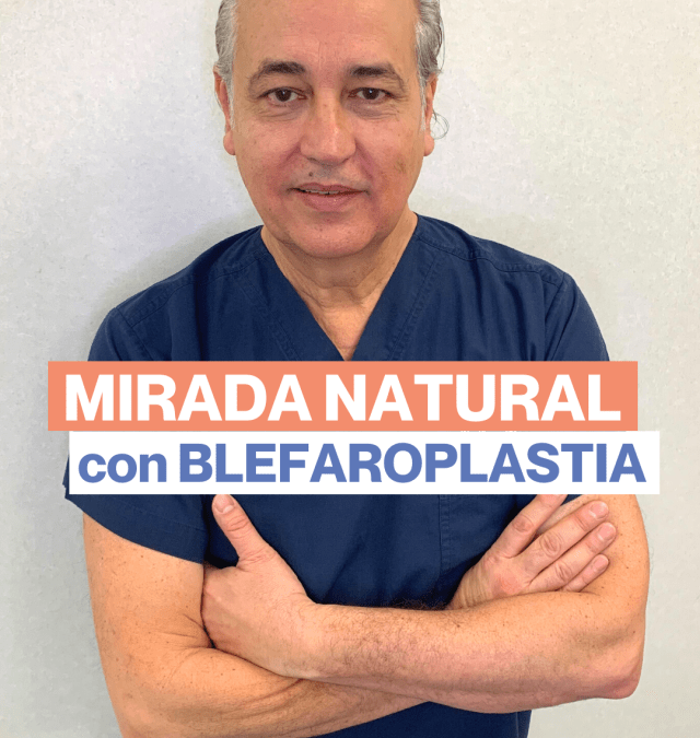 2 precauciones para dejar una mirada natural en una BLEFAROPLASTIA