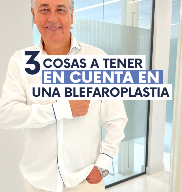 3 cosas a tener en cuenta antes de una BLEFAROPLASTIA