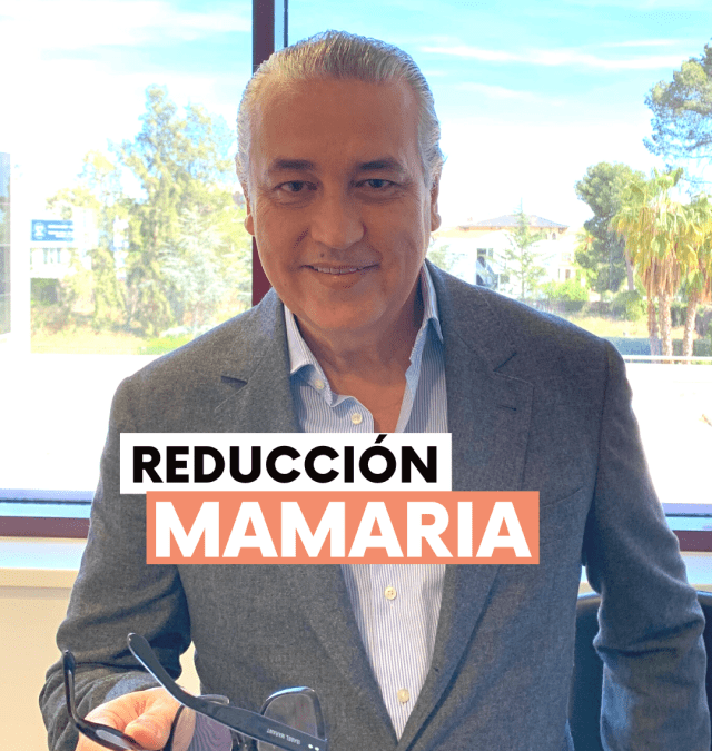 reducción mamaria, donde se ha realizado una reducción de la areola