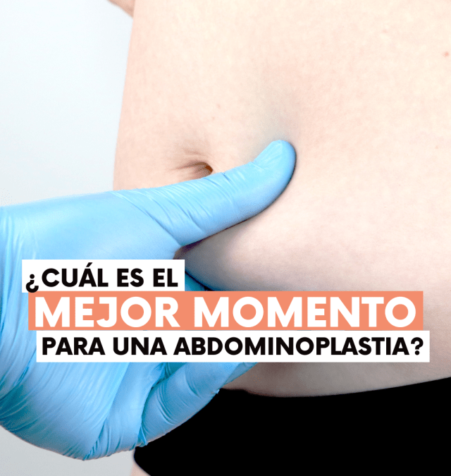 Momento adecuado para realizar una ABDOMINOPLASTIA
